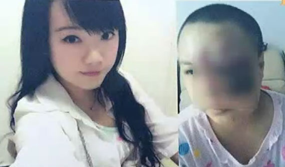 ��Ů������ͫ ������������